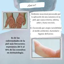 Image result for dermatitis contacta toxica