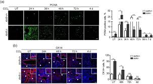 Excessive exposure to heat during hyperthermia cancer treatment or excessive time spent outdoors. Dioxin Receptor Adjusts Liver Regeneration After Acute Toxic Injury And Protects Against Liver Carcinogenesis Scientific Reports