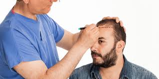 Although normally dormant, hair follicle stem cells (hfscs) quickly become activated to divide during a new hair cycle. All You Need To Know On Stem Cell Hair Transplant Njhrc Blog