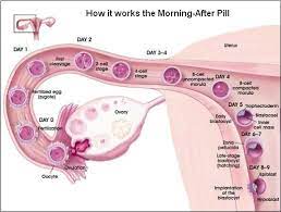 In other words, you should leave at least 1 month between two pills. Using The Morning After Pill And Making Your Decision Advice For Pregnant Moms