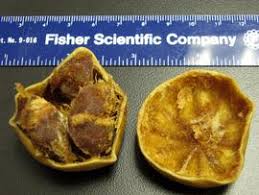 Image result for Vangueria sp.