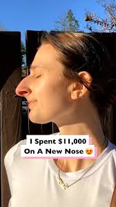 People say my kids will have my old nose... okay 🤷‍♀️ #fblifestyle