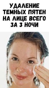 как избавиться от веснушек в домашних условиях за один день Pin Na Doske Zdorove