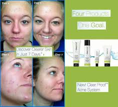 The mary kay clear proof set has 4 steps/products that are meant to help combat current and future acne breakouts. Www Marykay Com Clearproof Mary Kay Mary Kay Mary Kay Consultant