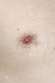 Male Hairy Nipple. Nipple With Hair. Easy Erotica And Humor. Without  Epilation. Stock Photo, Picture and Royalty Free Image. Image 125058130.
