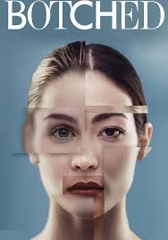 Botched Patients Botched Season Episode Full Episode Botched Dee's Bowling  Ball Full Episode Hotsell