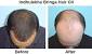 Before And After Indulekha Hair Oil