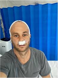 Cancer & My Road To Recovery