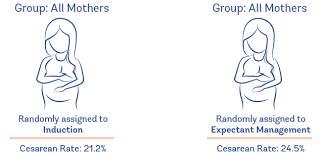 Evidence On: Inducing For Due Dates - Evidence Based Birth®
