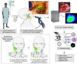 Image result for Primary Tumor Localization