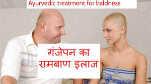 Votala hair growth treatment, hair serum, anti hair loss, thinning, balding, repairs hair follicles, promotes thicker, stronger hair, and promotes hair regrowth. Treatment Of Baldness Ganjapan In Hindi By Baba Ramdev Youtube
