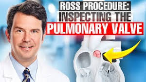 Ross Procedure: Inspecting the Pulmonary Valve