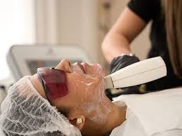 Rosacea Treatment London (Advanced IPL Rosacea Clinic)