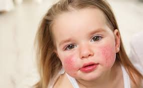 cocuklarda ciddiye alinmasi gereken dokuntuler yeditepe universitesi hastanesi