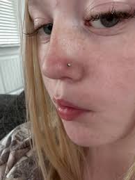 Is this normal 3 weeks after a new piercing?