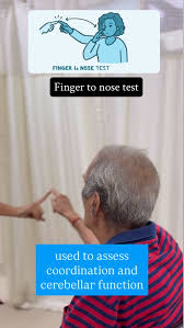 Image result for Cerebellar Function Test