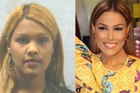 Fotos De Caroline Aquino Antes Y Despues De Adelgazar Tdwgqc Baokasal Site