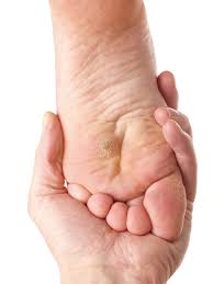 After 2 warts on my fingers and a plantars wart on the ball of my foot, let me start off by warning you about how hard getting rid of your. Plantar Warts Treatment Experienced Perth Foot Surgeon