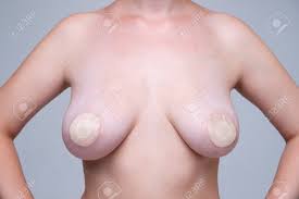 Large Female Breasts With Nipple Stickers On Gray Background, Stretch Marks  On The Skin, Body Care Concept, Close-up Studio Shot Stock Photo, Picture  and Royalty Free Image. Image 162136502.