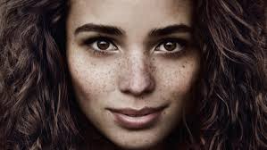 The gene responsible for this pigmentation combination was discovered by icelandic scientists while studying their own population. The Truth About Freckles