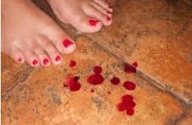 Vaginal bleeding from a period (menstruation) is heavy the first few days, then gradually lessens. How Much Bleeding During Pregnancy Is Normal