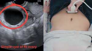 Image result for Ultrasound