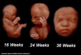 We did not find results for: When Is The Best Time To Get A 3d Ultrasound Mother Nurture Ultrasound
