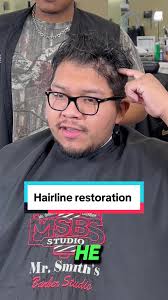 Cutting Off My Double Hairline