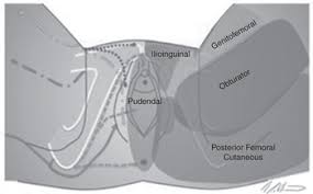 Image result for Pudendal Block