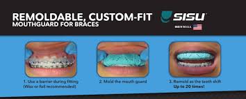 Mould your wax into a ball shape 3. Fitting With Braces Sisu Sports Mouthguards