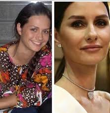 ''zara ne yaptın böyle kendine. Estetik Operasyon Geciren Unlulerin Eski Ve Yeni Halleri Nasil Kim Ne Estetik Yaptirdi Gozlerinize Inanamayacaginiz Karelerle Unlu Isimler A24 Galeri