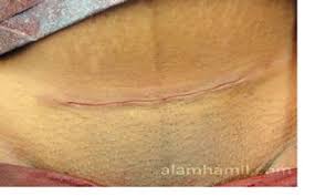 Check spelling or type a new query. Pembedahan Dr R Juhaidah Blog