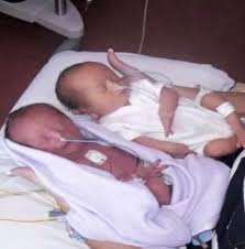 A couple was expecting identical twins but they were shocked to find out  what happened after the doctor told them &ldquo;sorry&rdquo; 😮 full story in the  comments 👇