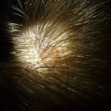 And to prevent potential hair loss. Hair Growth Molecule Uncovered Health24