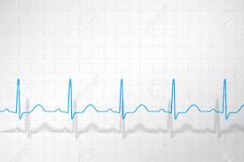 Normal Ecg Chart Of Healthy Man Conceptual Vector Background