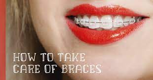Brush for two minutes twice daily and floss (or use other flossing devices) once daily to keep your mouth in top shape be gentle when brushing and flossing to avoid damaging the brackets and wires. How To Care For Teeth With Braces Tips For New Braces Wearers