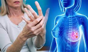 Metastatic, or stage 4, breast cancer is terminal, but many people live for decades after a diagnosis. Breast Cancer Symptoms And Signs Watch Out For Swelling In Your Arm Or Hand Express Co Uk