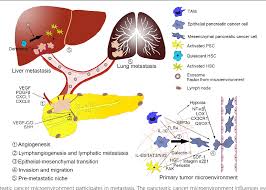 Pancreatic cancer is a deadly disease with high mortality due to difficulties in its early diagnosis and metastasis. Tumor Microenvironment Participates In Metastasis Of Pancreatic Cancer Semantic Scholar