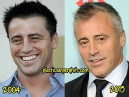 Could the response to matthew perry's merry friends merch be any more divided? Botox Plastic Surgery Hits