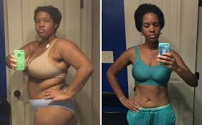 Before/After 1 - Margaret, 52