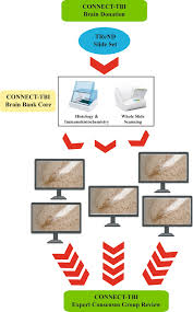 Tbi bank с решение за изцяло онлайн кредитиране. Collaborative Neuropathology Network Characterizing Outcomes Of Tbi Connect Tbi Acta Neuropathologica Communications Full Text