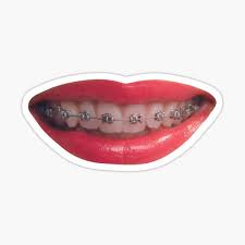 We also sell a synthetic mini pillow for young dogs with smaller mouths and a. Braces Smile Stickers Redbubble