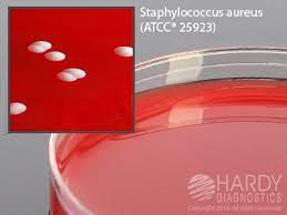 Principles of the procedure the nitrogen, vitamin, and carbon sources are provided by enzymatic digest of animal. Columbia Cna Agar 10pk Culture Media Key Scientific Products