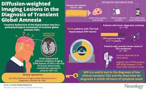 Image result for Transient Global Amnesia