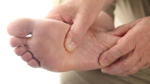 Saat bergerak secara horizontal, tubuh pun mulai mengalami perenggangan. Kaki Tangan Sejuk Tiba Tiba Walaupun Cuaca Panas Jangan Abaikan Kerana Gaya Hidup Cari Infonet
