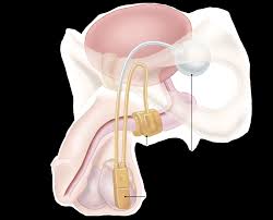 Image result for Penile Prosthesis