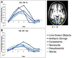 Aceasta zona va concentra cele mai noi definitii referitoare la foaie de varsamant. Frontiers The Vwfa It S Not Just For Words Anymore Human Neuroscience