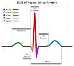 Ecg Of Normal Sinus Rhythm Infographic Diagram Showing Normal