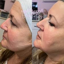 Unfiltered Aesthetics