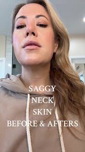 Go Pure Neck Cream Michelle